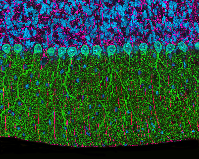 Illustration for article titled Estas son algunas de las fotos microscópicas más espectaculares del año